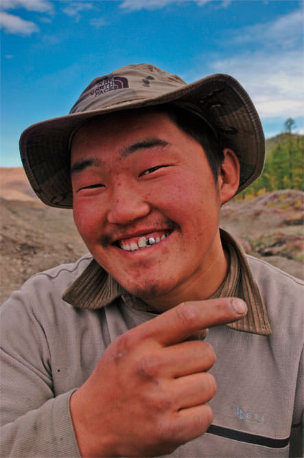 25. mongolia teeth
